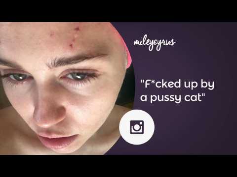 VIDEO : Miley Cyrus nurses wounds after vicious cat attack