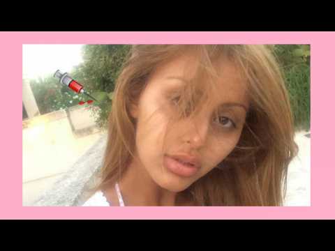 VIDEO : Zahia mconnaissable : Abus de chirurgie esthtique repr !