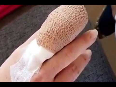 VIDEO : Lindsay Lohan casi pierde un dedo en un accidente