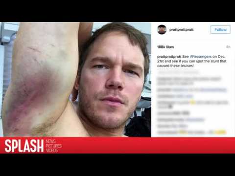 VIDEO : Chris Pratt Shows Terrible Bruises From 'Passengers' Stunts