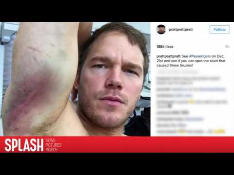 VIDEO : Chris Pratt montre les bleus qu'il s'est fait durant le tournage de Passengers