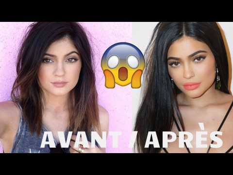 VIDEO : Avant / Aprs : Kylie Jenner, son incroyable transformation physique