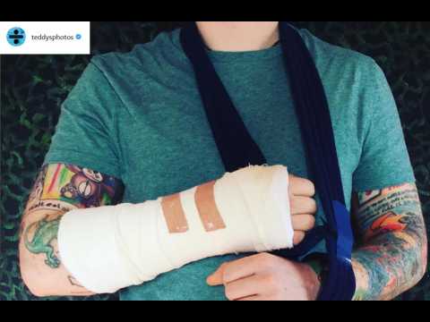 VIDEO : Ed Sheeran annule certaines dates de sa tournée, après avoir fracturé ses bras