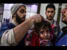 Syrie : le témoignage terrible des médecins de la Ghouta assiégée