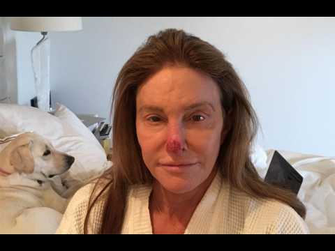 VIDEO : Caitlyn Jenner has sun damage removed from nose