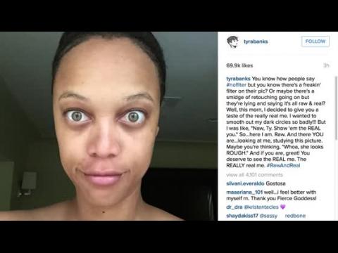 VIDEO : Tyra Banks & Other Celebs Go Makeup-Free on Instagram