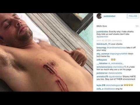 VIDEO : Un ami de Justin Bieber s'est fait mordre par un requin