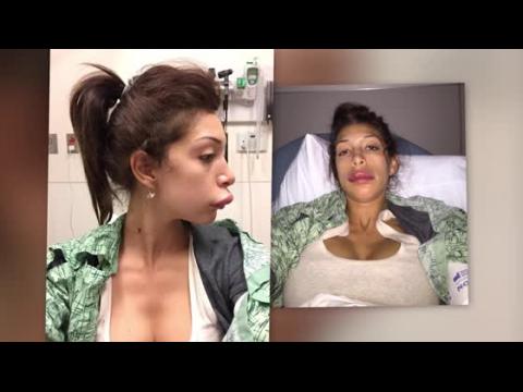 VIDEO : Farrah Abraham's Lip Injections Go Horribly Wrong