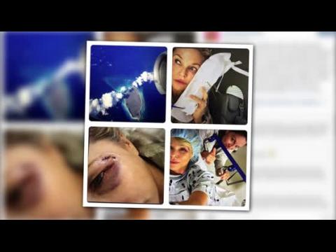 VIDEO : Christie Brinkley Injured After Altercation With a Bird