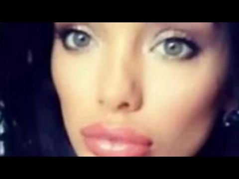 VIDEO : Kylie Jenner avoue qu'elle a eu recours  la chirurgie esthtique