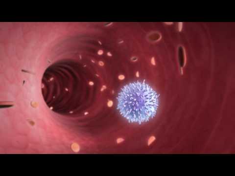 VIDEO : New Testing Method Reduces HIV Infections