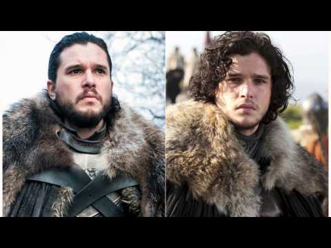 VIDEO : 'Game Of Thrones' Star Kit Harington Gets Treatment For Stress