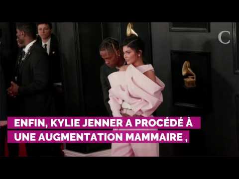 VIDEO : Kylie Jenner mtamorphose : ses oprations de chirurgie estimes  plus de 30 000 euros