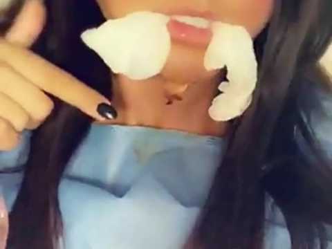 VIDEO : Aurlie Dotremont dvoile son visage tumfi aprs deux nouvelles oprations de chirurgie es