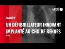 Santé. Un nouveau défibrillateur innovant implanté au CHU de Rennes