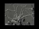 Des neurones vieux de 2000 ans découverts chez une victime de l'éruption du Vésuve