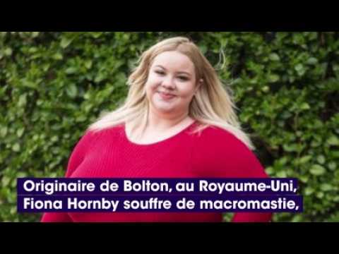 VIDEO : Royaume-Uni : cette jeune femme souffre de macromastie, sa poitrine ne cesse d?augmenter !