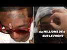 Le rappeur Lil Uzi Vert s'est fait implanter un diamant de 11 carats sur le front