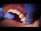 Dental device promises pain-free tooth repair