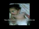 Starving baby puts human face on Madaya crisis