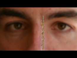 Surgical stentrode could revolutionise thought control tech