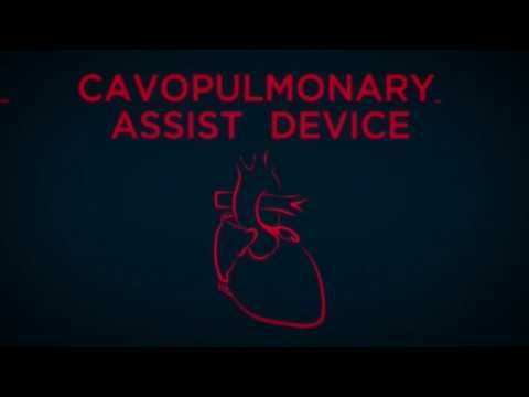 New animation shows potential heart pump motor featuring NASA technology