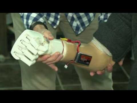 Son designs prosthetic arm for amputee dad