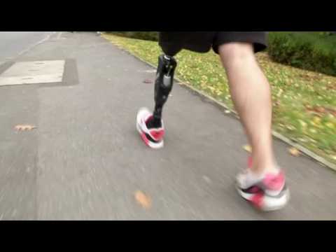 Intelligent prosthetic leg automatically adjusts to the terrain