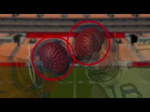 NFL acknowledges link between football and brain disease