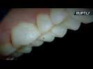 Dentist Carves Putin and Trump Images Onto Patient's False Teeth