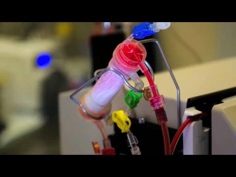 New device could save millions from septic shock
