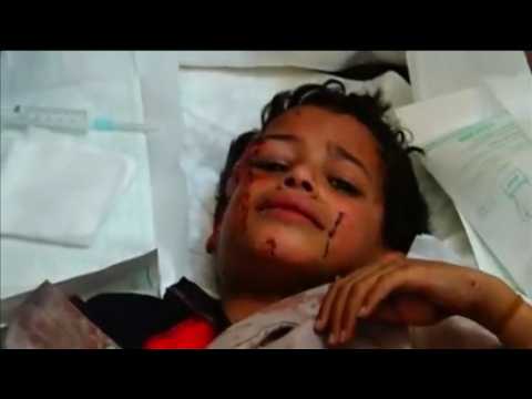 School in Yemen hit by air strike