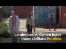 Yemeni civilians lose limbs to landmines