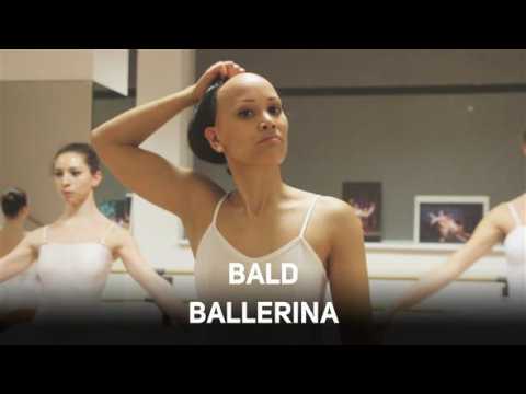 No hair, no limits: bald ballerina