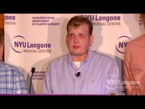 Face transplant recipient "feeling great" one year later