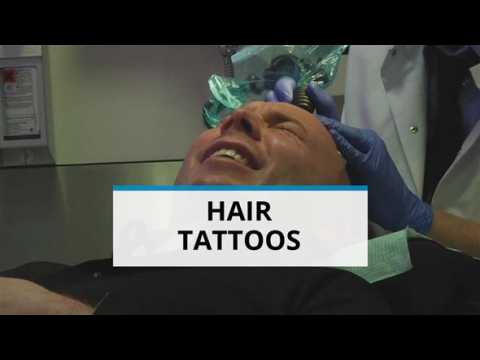 Hair tattoos, the ultimate solution to baldness