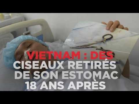 Vietnam : des ciseaux retirés de son estomac 18 ans après