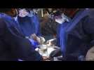 Première médicale mondiale : un coeur de cochon greffé sur un patient américain de 57 ans