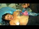 Au Brésil, des tatouages pour masquer les cicatrices de la vie