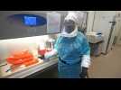 Espagne : deuxième décès d'un patient contaminé par la variole du singe