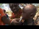 'Life-saving' peanut paste shortage threatens more malnutrition in northern Kenya