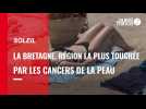 VIDEO. Soleil: La Bretagne championne de France des cancers de la peau
