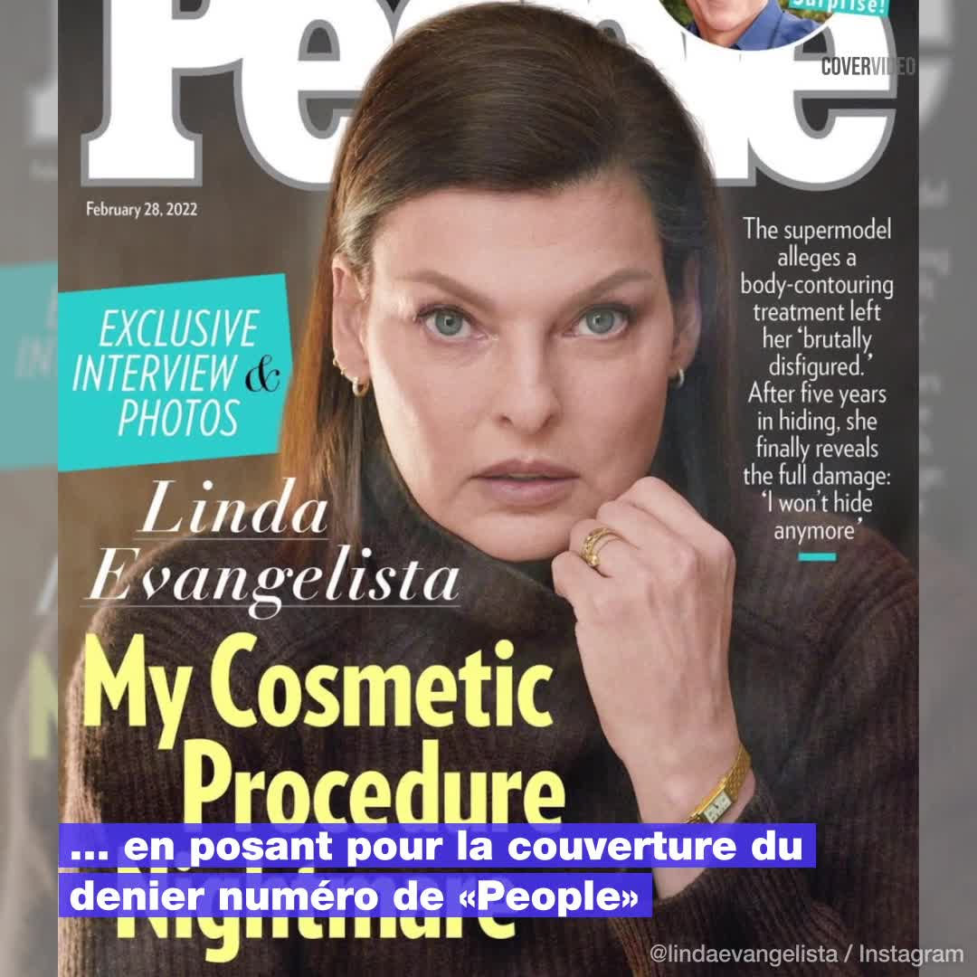 Mannequin Defiguree Par La Chirurgie Esthetique Défigurée par la chirurgie esthétique, Linda Evangelista ne veut plus se  cacher