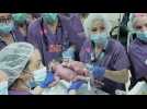Doctors separate 1-year-old conjoined twins for first time in Israel