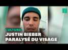 Paralysé d'un côté du visage, Justin Bieber annule des dates de concert