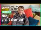 Greffé rénal par deux fois, Noa témoigne pour le don d'organes