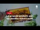 VIDEO. La propolis produite par les abeilles réduit l'acné