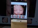 Cette IA rend les échographies beaucoup plus réalistes  #ia #mwc