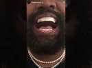 Kanye West s'est-il fait arracher les dents pour des grillz ?