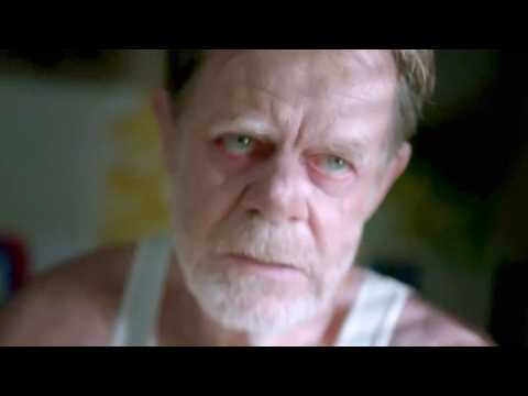 Shameless (US) - Teaser 2 - VO